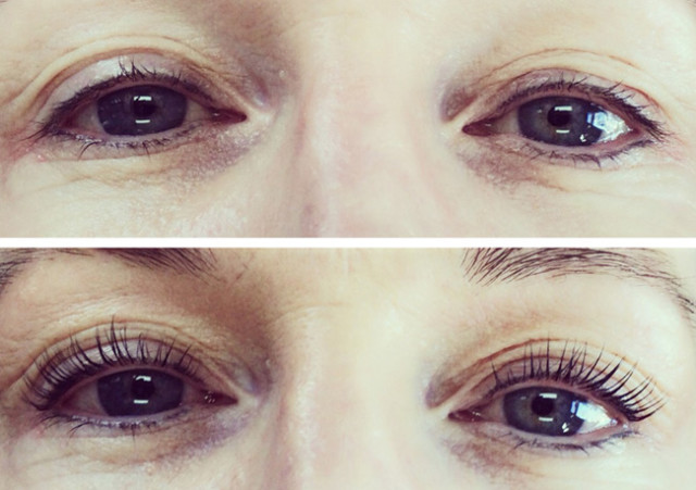 medicine-of-cosmetics-lash-lift-before-and-after